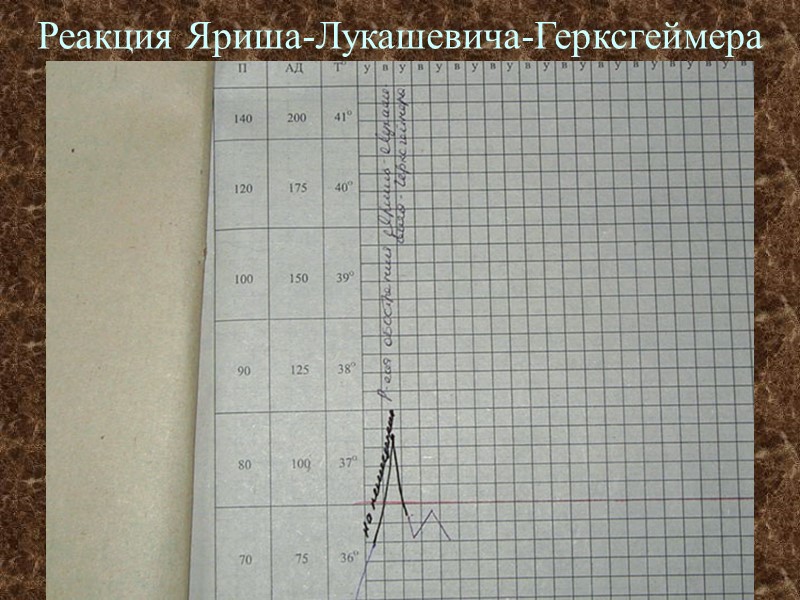 Реакция Яриша-Лукашевича-Герксгеймера